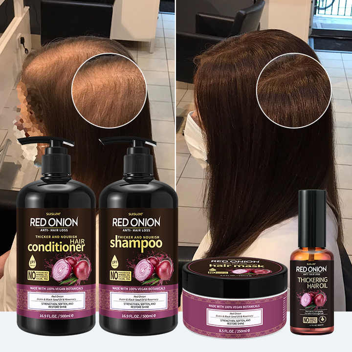 Suisuale Red Onion Anti-Hair Loss Shampoo & Conditioner Set of 4 pieces